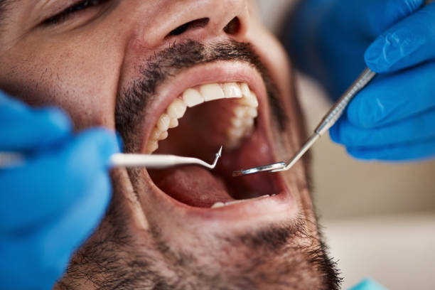 Best Emergency Treatment for Dental Infections or Abscesses in South Zanesville, OH