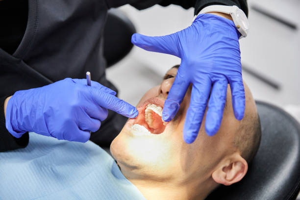 Best Emergency Wisdom Teeth Removal in South Zanesville, OH