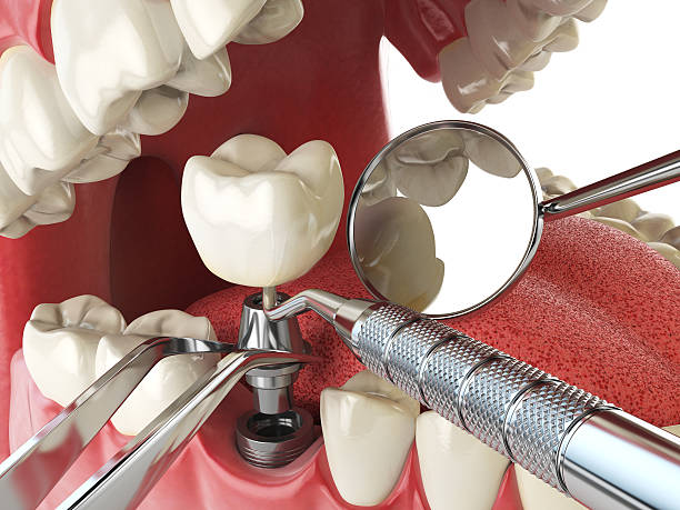 Best Emergency Gum Treatment in South Zanesville, OH